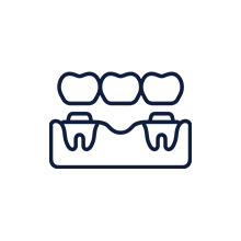 Prosthodontics 膺復假牙